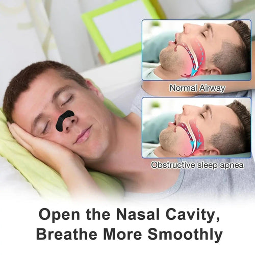Anti Snoring Nasal Strips